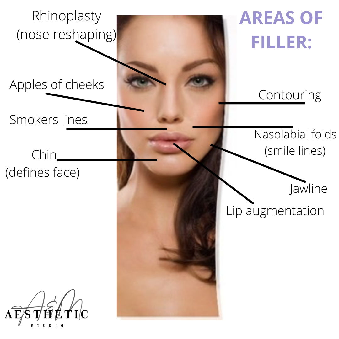 DERMAL FILLER AREAS